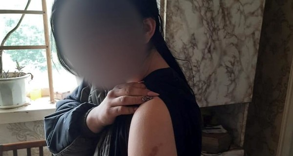 На Луганщине мать посадила на цепь свою 14-летнюю дочь