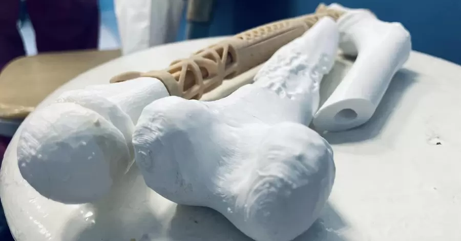 Ученая из КПИ печатает кости на 3D-принтере: длина имплантов достигает 40 сантиметров